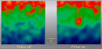 Fermi LAT observation of the youngest millisecond pulsar, PSR J1823-3021A