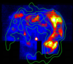 Particle Acceleration in RXJ 1713.7-3946