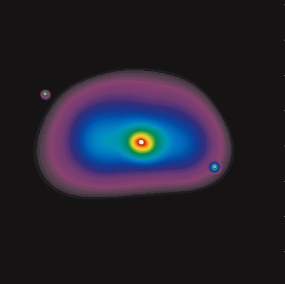 NGC 1700 CHANDRA Image