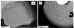 GRB-induced Chondrules