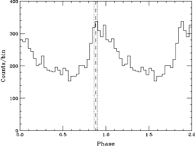 pulse profile