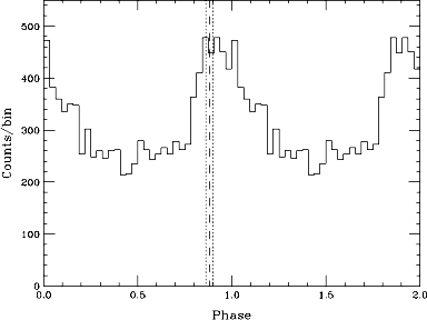 pulse profile