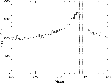 pulse profile