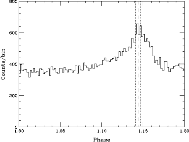 pulse profile