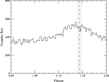 pulse profile