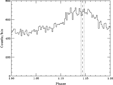 pulse profile